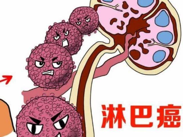 1637304207698398.jpg 杭州淋巴瘤治疗好医馆