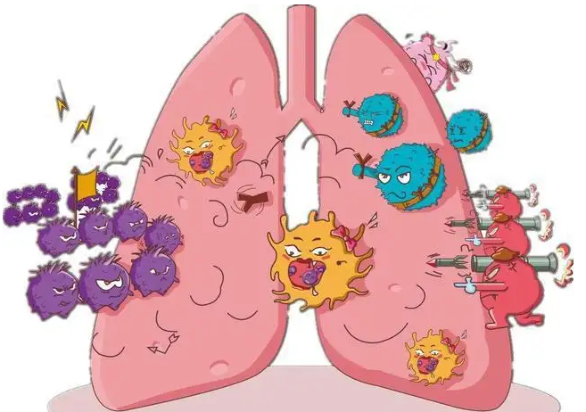 杭州御和堂中医：与肺癌病因密切相关的五大因素