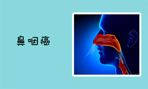 鼻咽癌的病因是什么导致的？