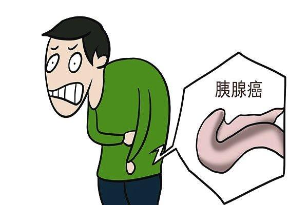 哪些胰腺癌的症状更容易被人忽略