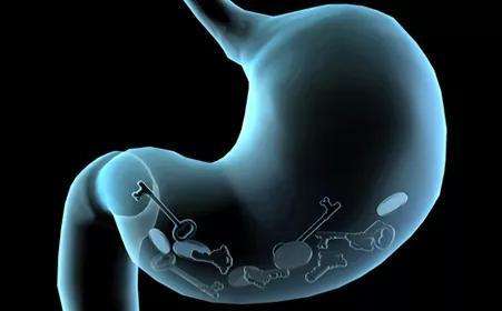 杭州哪个医馆治疗胃癌比较好