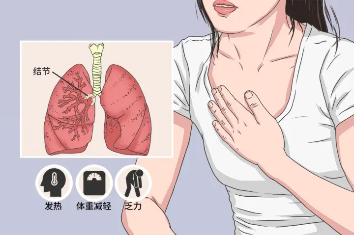 1660285524135479.jpg 杭州御承堂中医:肺部结节多大才是肺癌